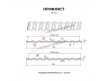 Профлист Металл Профиль МП-20x1100-R (ECOSTEEL_MA-01-Беленый Дуб-0,5)